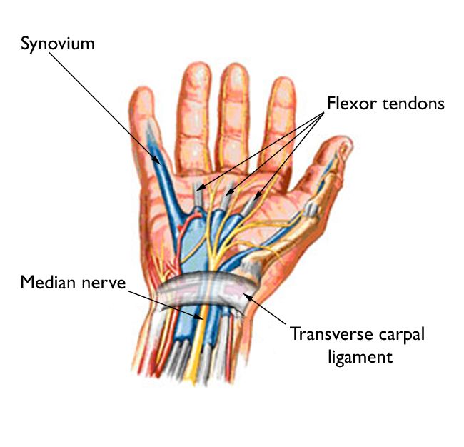 slash resistant gloves hands nerves tendons